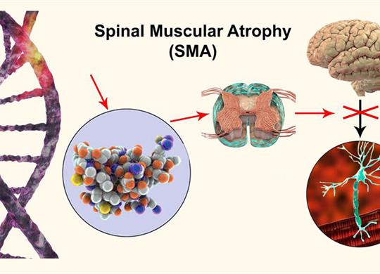 Counseling and Genetic Diagnosis of Spinal Muscular Atrophy